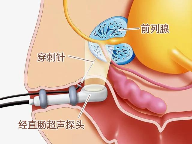 医生:3招让医生:3招让