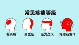 这个医生说“结石痛”是好事