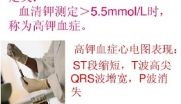 【病症科普】高钾血症